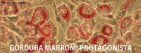 Exercícios promovem aumento da Gordura Marrom